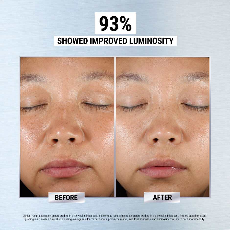 Corrector for online dark spots